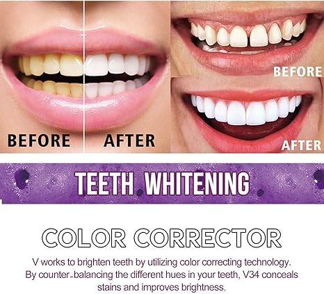 toothpaste for teeth whitening (30ml)